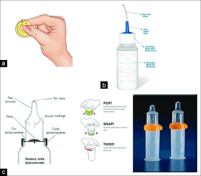 Mead johnson cleft lip palate nurser