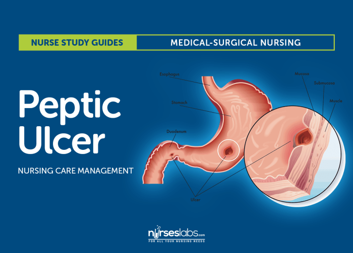 Peptic ulcer hesi case study