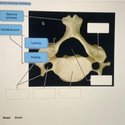 Vertebrae vertebral cervical thoracic bones lumbar physiology axial spinal medical amplifire kf1