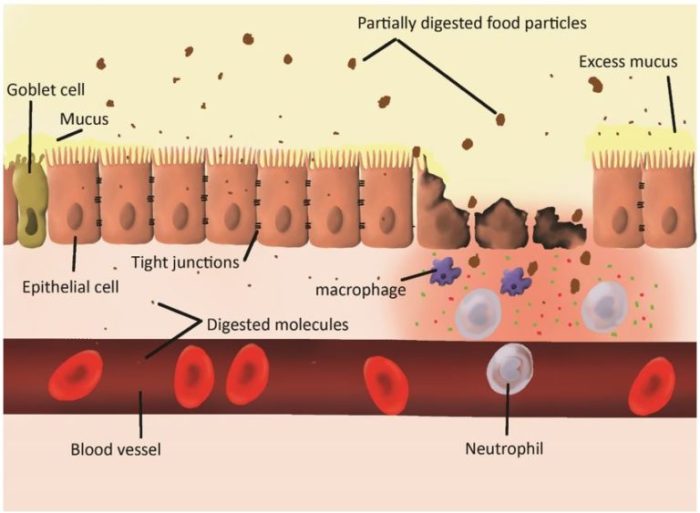 Cell lining the small intestine assembles fats