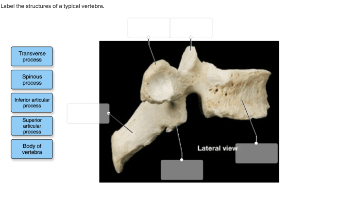 Label the structures of the typical vertebra